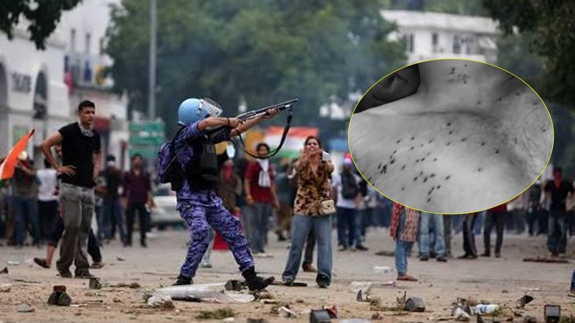 Hospital confirms pellet gun injuries to 10 protesters on July 20